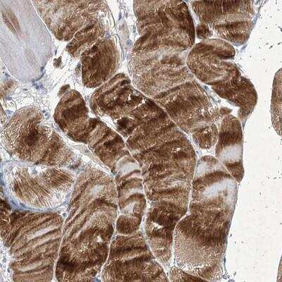 Immunohistochemistry: COX15 Antibody [NBP1-86271]