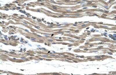 Immunohistochemistry-Paraffin: COX15 Antibody [NBP1-59560]