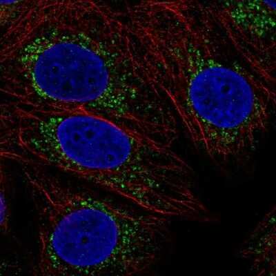 Immunocytochemistry/ Immunofluorescence: COX16 Antibody [NBP2-31863]