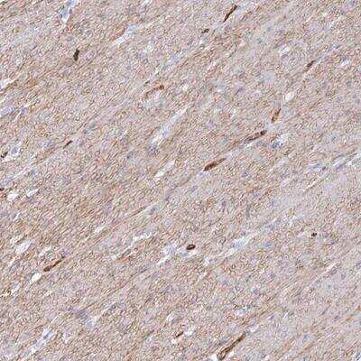 Immunohistochemistry-Paraffin: COX16 Antibody [NBP2-31863]