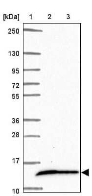 Western Blot: COX16 Antibody [NBP2-31863]