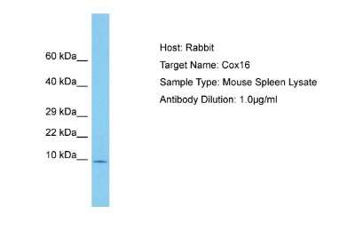 Western Blot: COX16 Antibody [NBP2-82746]