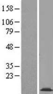 Western Blot: COX16 Overexpression Lysate [NBL1-09406]