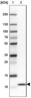 Western Blot: COX17 Antibody [NBP2-30980]