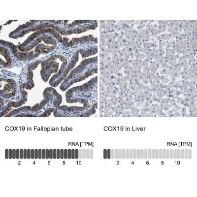 Immunohistochemistry-Paraffin: COX19 Antibody [NBP1-82769]