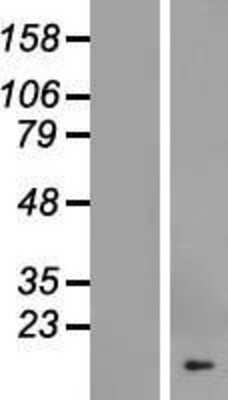 Western Blot: COX19 Overexpression Lysate [NBL1-09408]