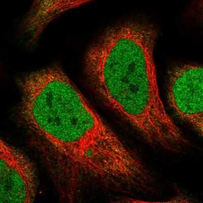 Immunocytochemistry/ Immunofluorescence: COX3 Antibody [NBP1-88063]