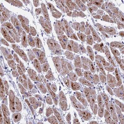 Immunohistochemistry-Paraffin: COX3 Antibody [NBP1-88063]