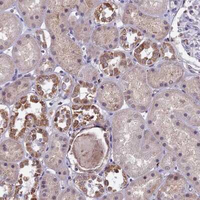 Immunohistochemistry-Paraffin: COX3 Antibody [NBP1-88063]