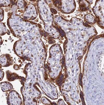 Immunohistochemistry-Paraffin: COX3 Antibody [NBP1-88063]