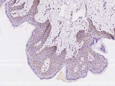 Immunohistochemistry-Paraffin: COX3 Antibody [NBP2-97594]