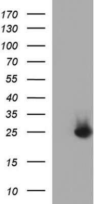 Western Blot: COX4NB Antibody (OTI1D6) [NBP2-46343]