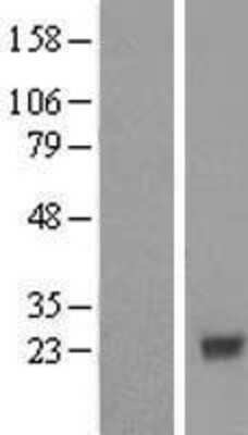 Western Blot: COX4NB Overexpression Lysate [NBL1-09411]