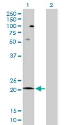 Western Blot: COX5A Antibody [H00009377-D01P]