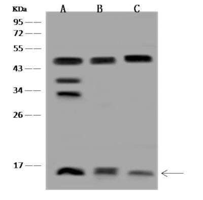 Western Blot: COX5A Antibody [NBP3-06072]