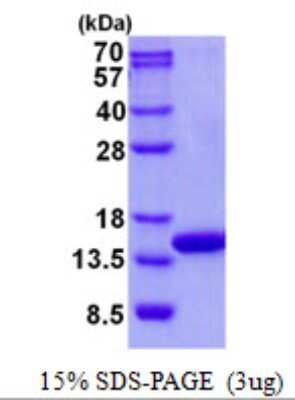 SDS-PAGE: Recombinant Human COX5A His Protein [NBP2-22981]