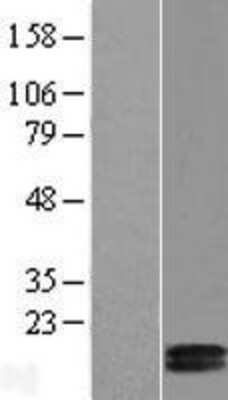 Western Blot: COX5b Overexpression Lysate [NBL1-09413]