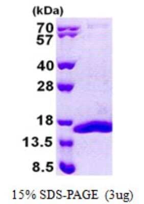 SDS-PAGE: Recombinant Human COX5b His Protein [NBP2-22982]