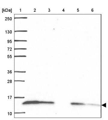 Western Blot: COX6A1 Antibody [NBP2-46865]