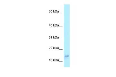 Western Blot: COX6A1 Antibody [NBP2-84721]