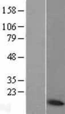 Western Blot: COX6A1 Overexpression Lysate [NBL1-09414]