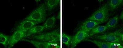 Immunocytochemistry/ Immunofluorescence: COX6A2 Antibody [NBP1-31112]