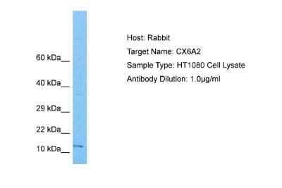 Western Blot: COX6A2 Antibody [NBP2-83980]