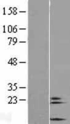 Western Blot: COX6A2 Overexpression Lysate [NBL1-09415]