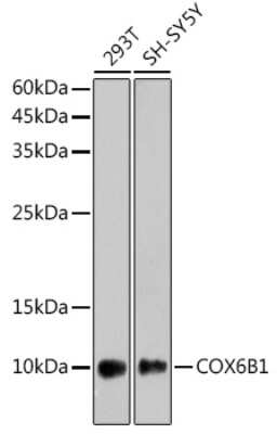 Western Blot: COX6B1 Antibody (7T0J5) [NBP3-16098]