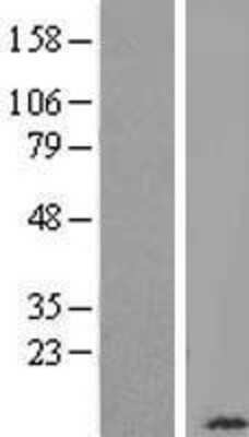 Western Blot: COX6B1 Overexpression Lysate [NBL1-09416]