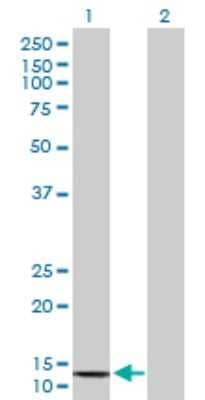 Western Blot: COX6B2 Antibody [H00125965-B01P]