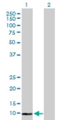 Western Blot: COX6B2 Antibody [H00125965-D01P]