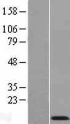 Western Blot: COX7A2 Overexpression Lysate [NBP2-08167]