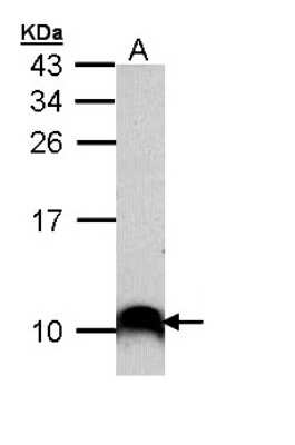 Western Blot: COX7B2 Antibody [NBP1-33386]