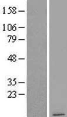 Western Blot: COX7B2 Overexpression Lysate [NBL1-09421]