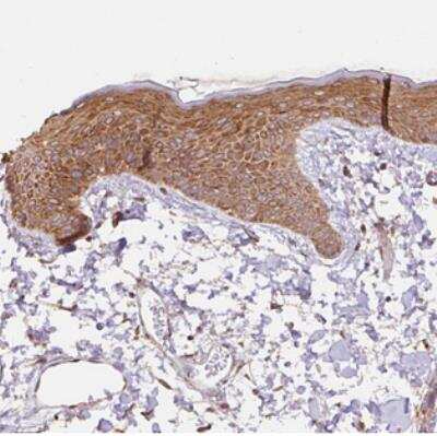 Immunohistochemistry: COX8A Antibody [NBP2-30764]