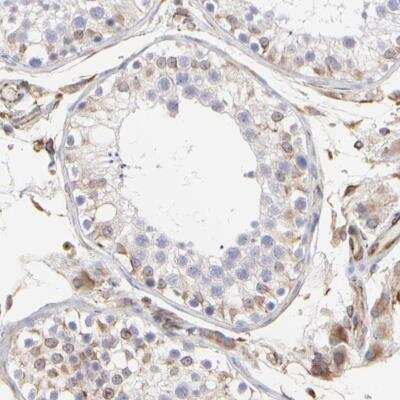 Immunohistochemistry-Paraffin: COX8C Antibody [NBP1-84400]