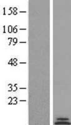 Western Blot: COX8C Overexpression Lysate [NBP2-04790]