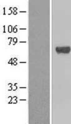 Western Blot: TFCP2 Overexpression Lysate [NBL1-16833]