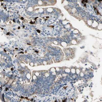 Immunohistochemistry-Paraffin: CPA3 Antibody [NBP1-86117]