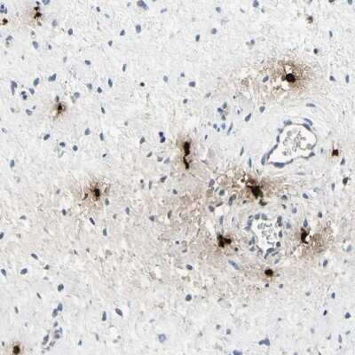 Immunohistochemistry-Paraffin: CPA3 Antibody [NBP1-86117]