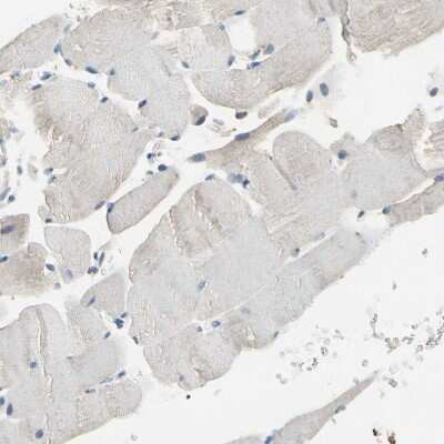 Immunohistochemistry-Paraffin: CPA3 Antibody [NBP1-86117]