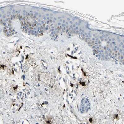 Immunohistochemistry-Paraffin: CPA3 Antibody [NBP1-86117]