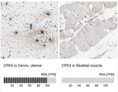 Immunohistochemistry-Paraffin: CPA3 Antibody [NBP1-86117]