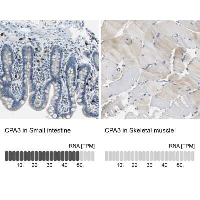 Immunohistochemistry-Paraffin: CPA3 Antibody [NBP1-86130]