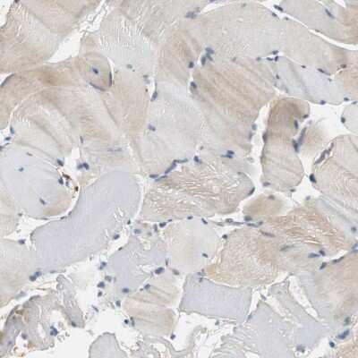 Immunohistochemistry-Paraffin: CPA3 Antibody [NBP1-86130]