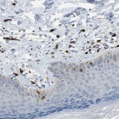 Immunohistochemistry-Paraffin: CPA3 Antibody [NBP1-86130]