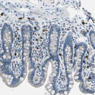 Immunohistochemistry-Paraffin: CPA3 Antibody [NBP1-86130]