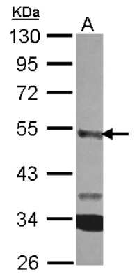 Western Blot: CPA3 Antibody [NBP2-15978]