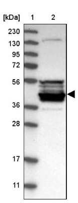 Western Blot: CPA5 Antibody [NBP1-91807]